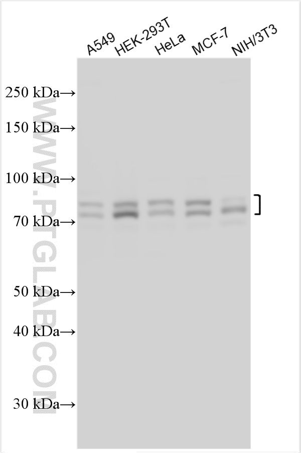 Western Blot (WB) analysis of various lysates using MTA1 Polyclonal antibody (30545-1-AP)