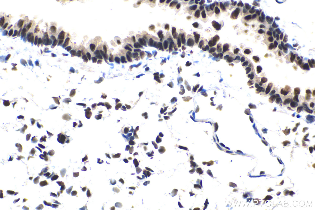 Immunohistochemistry (IHC) staining of rat lung tissue using MTA2 Polyclonal antibody (17554-1-AP)