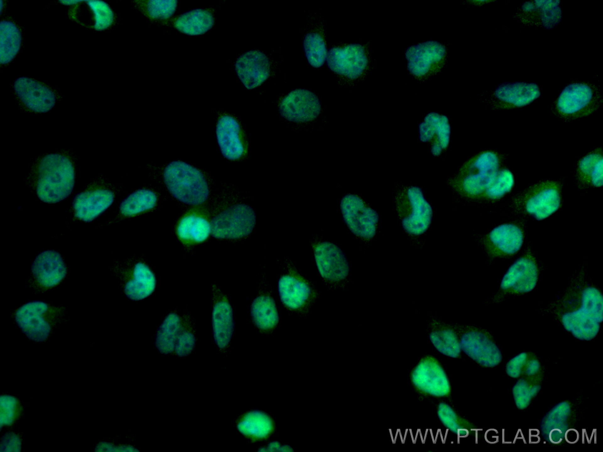 Immunofluorescence (IF) / fluorescent staining of U-251 cells using MTA3 Polyclonal antibody (14682-1-AP)