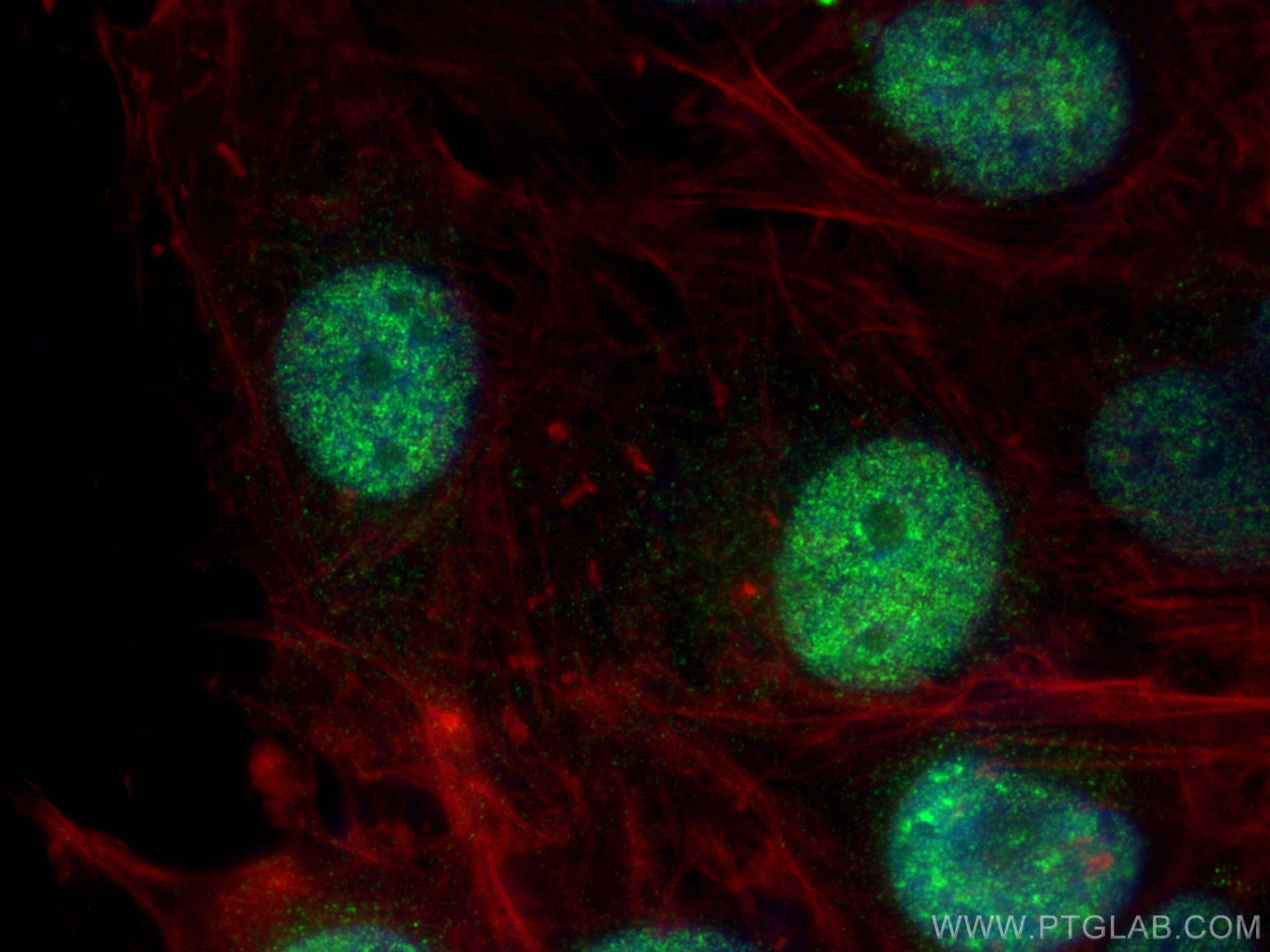 Immunofluorescence (IF) / fluorescent staining of U-251 cells using MTA3 Polyclonal antibody (14682-1-AP)