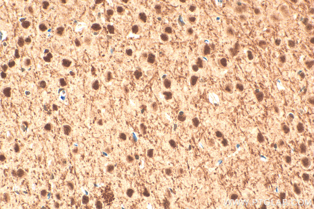 Immunohistochemistry (IHC) staining of mouse brain tissue using MTA3 Polyclonal antibody (14682-1-AP)