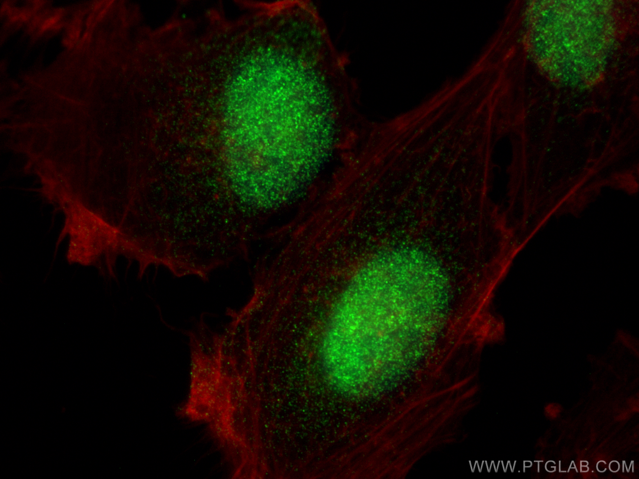 Immunofluorescence (IF) / fluorescent staining of U-251 cells using MTA3 Recombinant antibody (83042-3-RR)