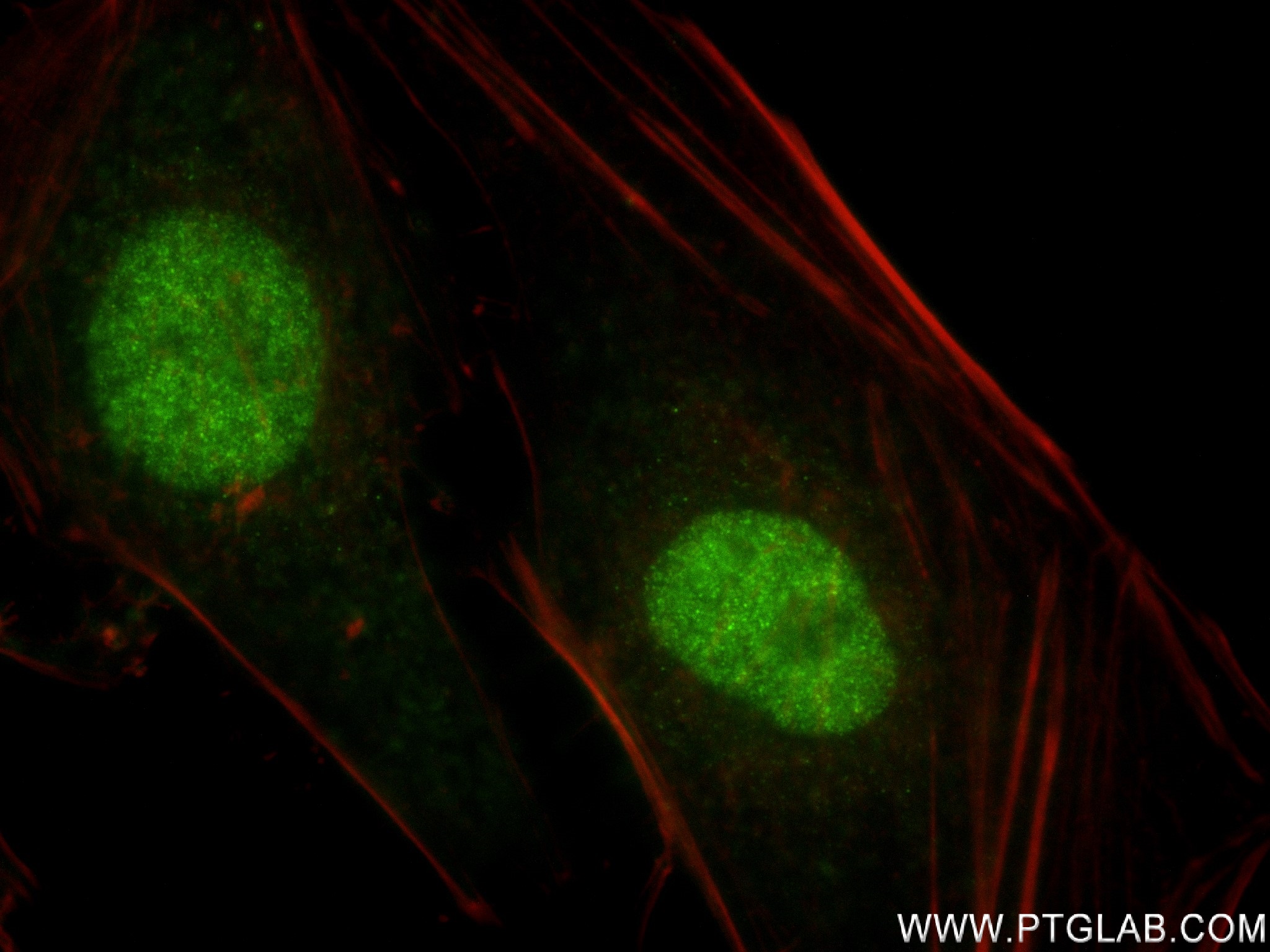 Immunofluorescence (IF) / fluorescent staining of HeLa cells using MTF2 Recombinant antibody (82944-1-RR)