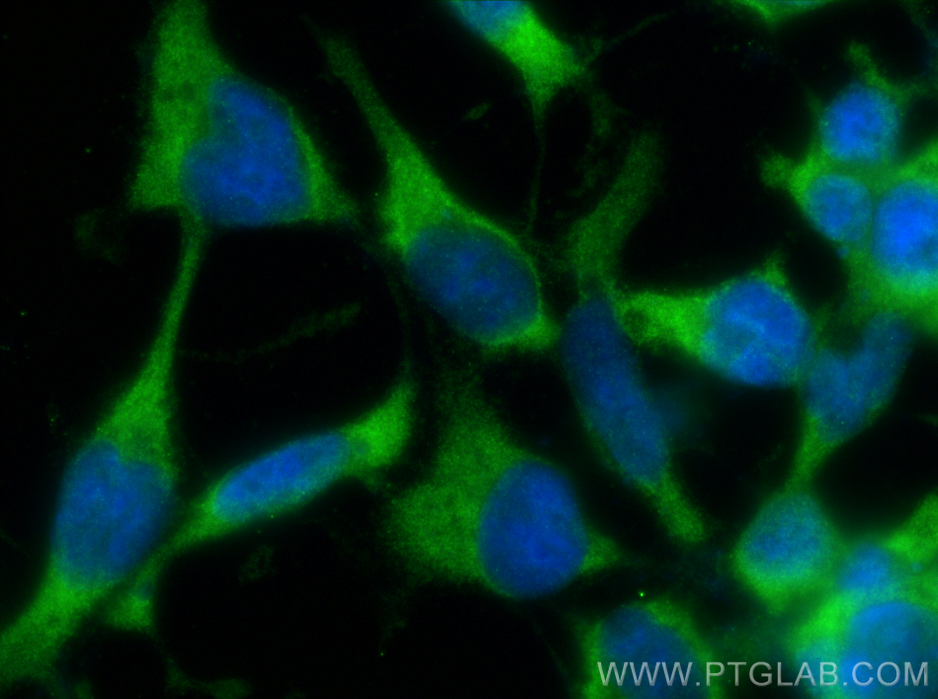 Immunofluorescence (IF) / fluorescent staining of HEK-293 cells using MTHFD1 Polyclonal antibody (10794-1-AP)