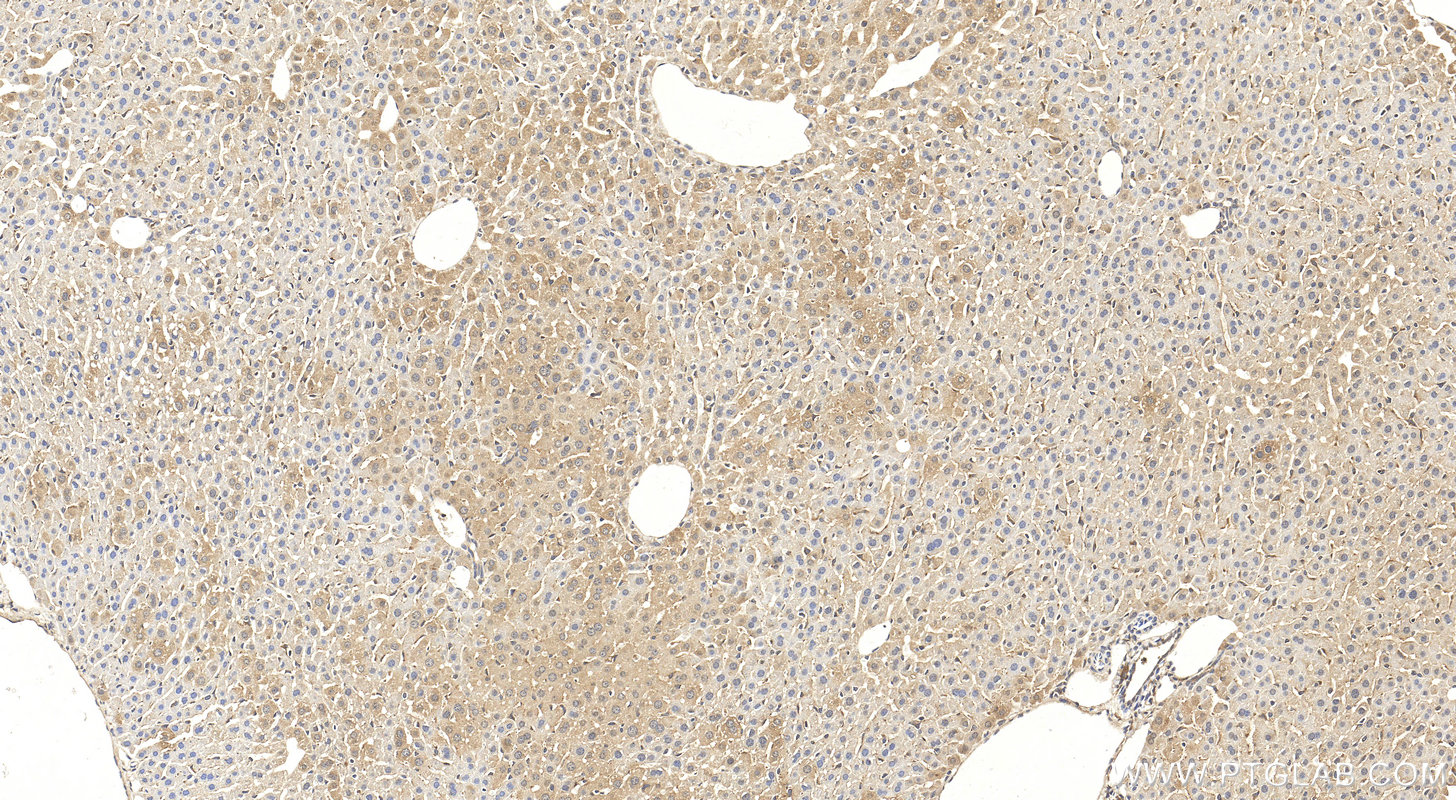 Immunohistochemistry (IHC) staining of mouse liver tissue using MTHFD1 Polyclonal antibody (10794-1-AP)