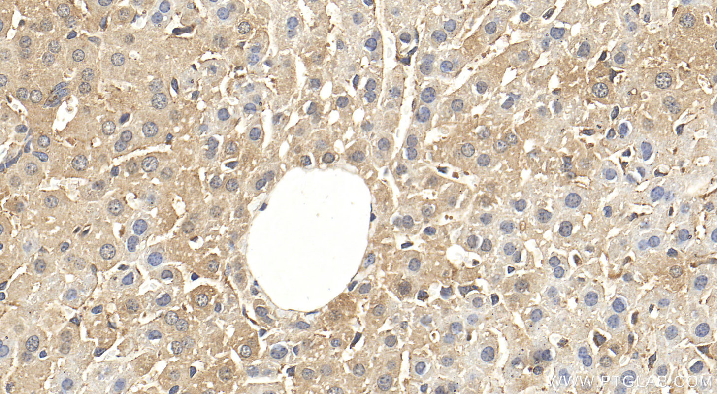 Immunohistochemistry (IHC) staining of mouse liver tissue using MTHFD1 Polyclonal antibody (10794-1-AP)