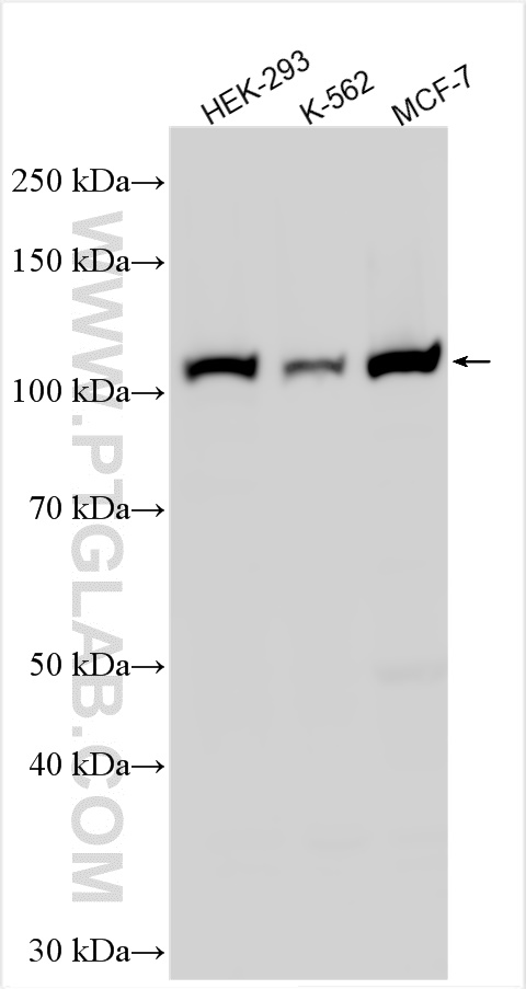 Western Blot (WB) analysis of various lysates using MTHFD1 Polyclonal antibody (10794-1-AP)