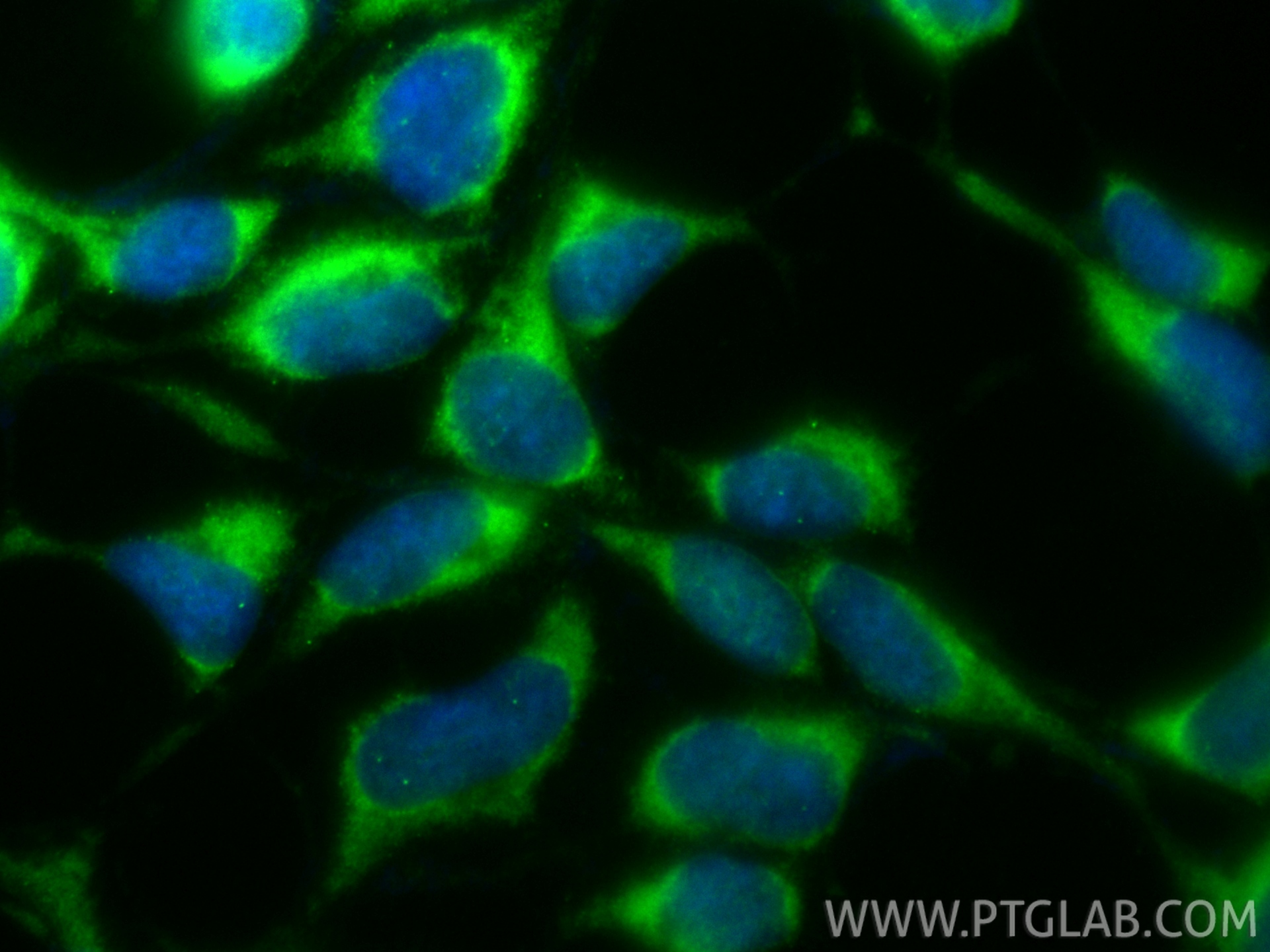 Immunofluorescence (IF) / fluorescent staining of HEK-293 cells using CoraLite® Plus 488-conjugated MTHFD1 Recombinant m (CL488-84884-5)