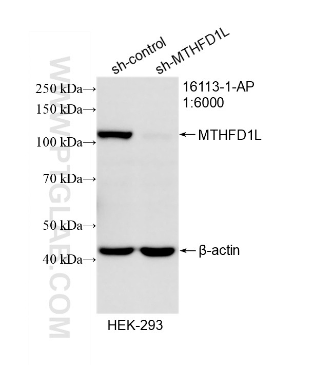 Western Blot (WB) analysis of HEK-293 cells using MTHFD1L Polyclonal antibody (16113-1-AP)