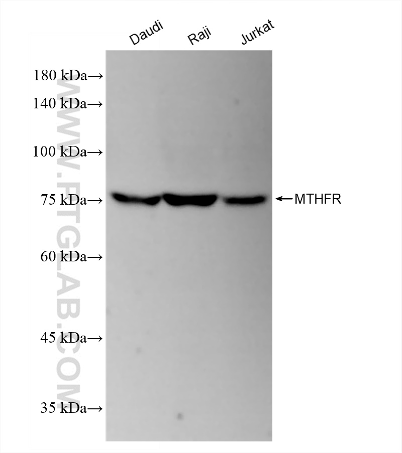 Western Blot (WB) analysis of various lysates using MTHFR Recombinant antibody (83372-7-RR)