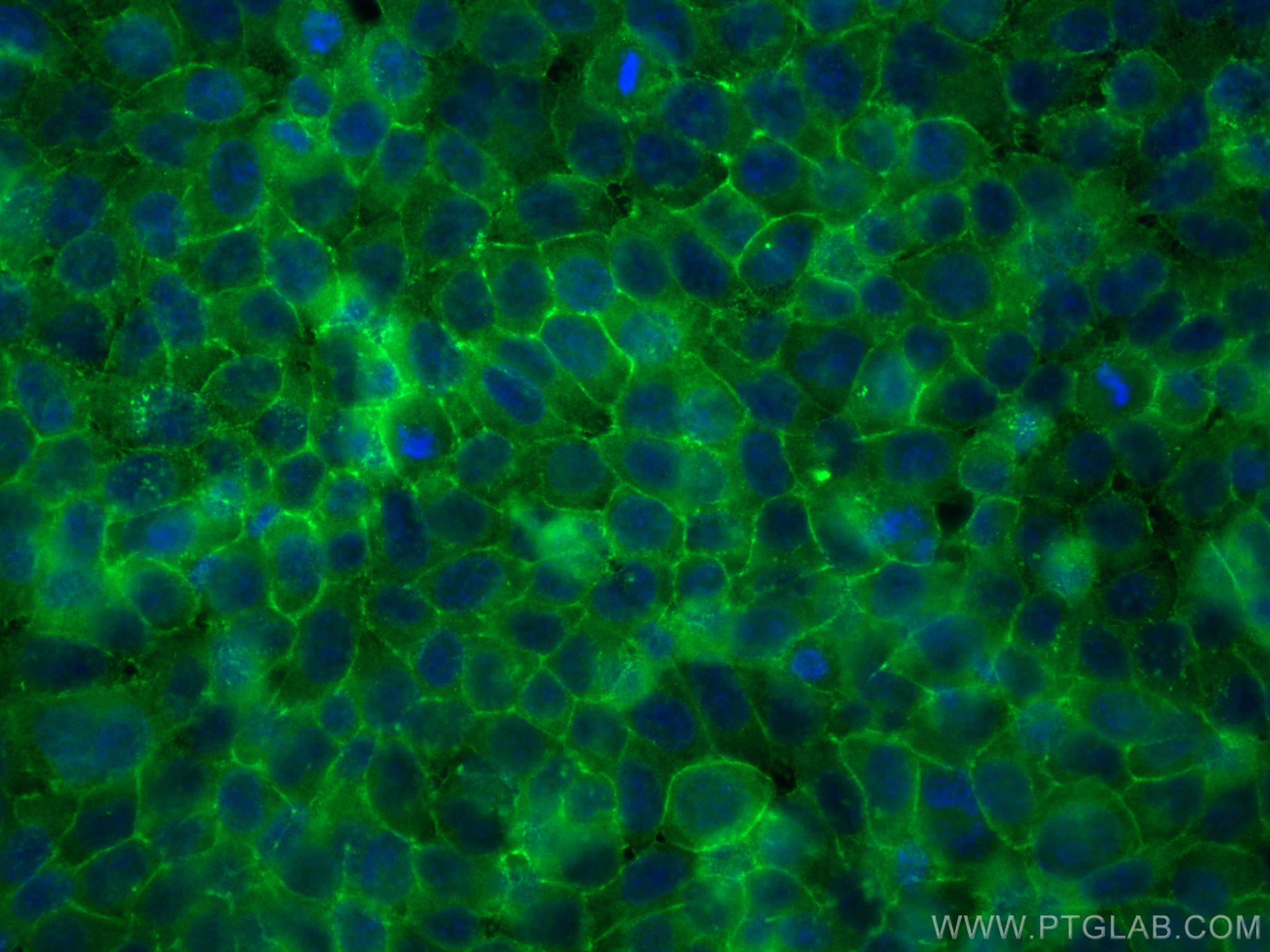 Immunofluorescence (IF) / fluorescent staining of L02 cells using MTM1 Polyclonal antibody (13924-1-AP)