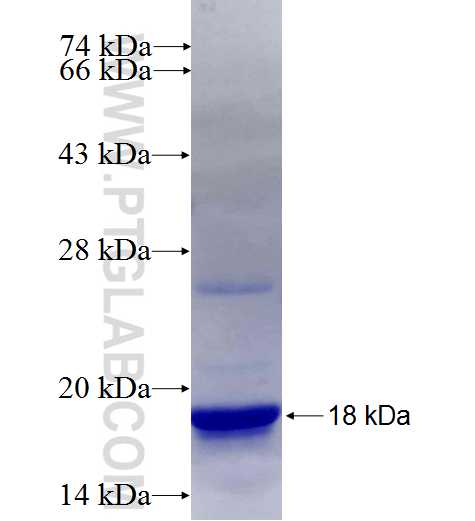 MTMR1 fusion protein Ag27125 SDS-PAGE