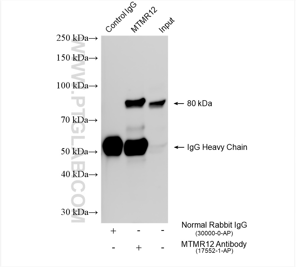 Immunoprecipitation (IP) experiment of K-562 cells using MTMR12 Polyclonal antibody (17552-1-AP)