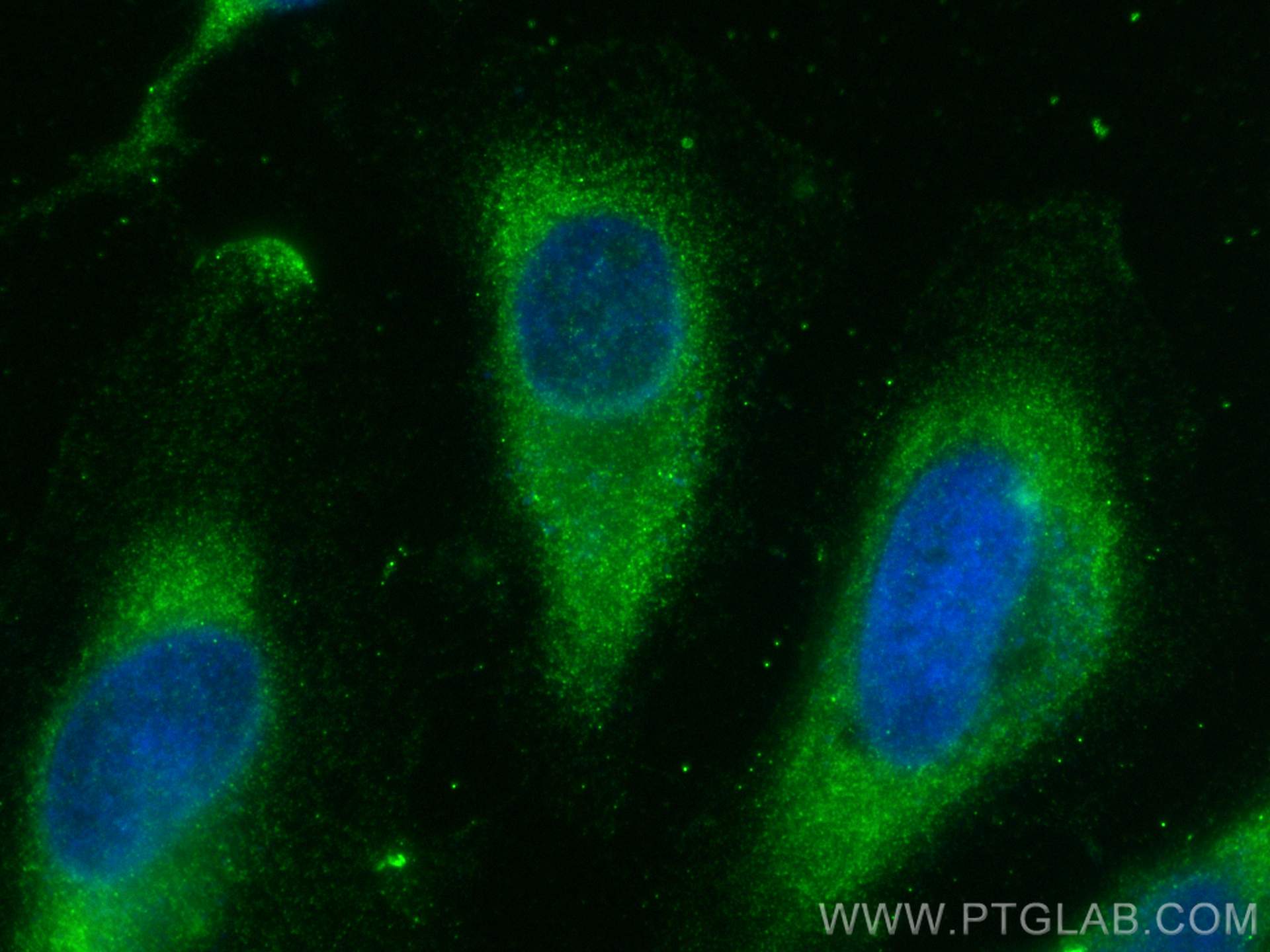 Immunofluorescence (IF) / fluorescent staining of HeLa cells using MTMR14 Polyclonal antibody (14973-1-AP)