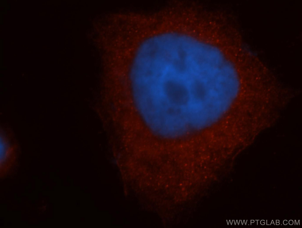 Immunofluorescence (IF) / fluorescent staining of HeLa cells using MTMR14 Polyclonal antibody (14973-1-AP)