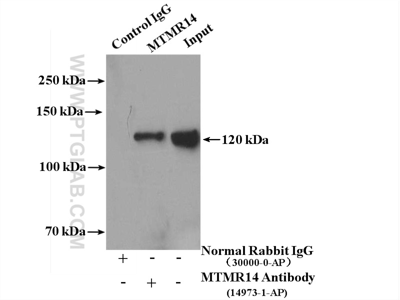 Immunoprecipitation (IP) experiment of HeLa cells using MTMR14 Polyclonal antibody (14973-1-AP)