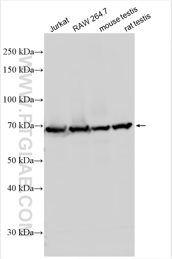 Western Blot (WB) analysis of various lysates using MTMR14 Polyclonal antibody (14973-1-AP)