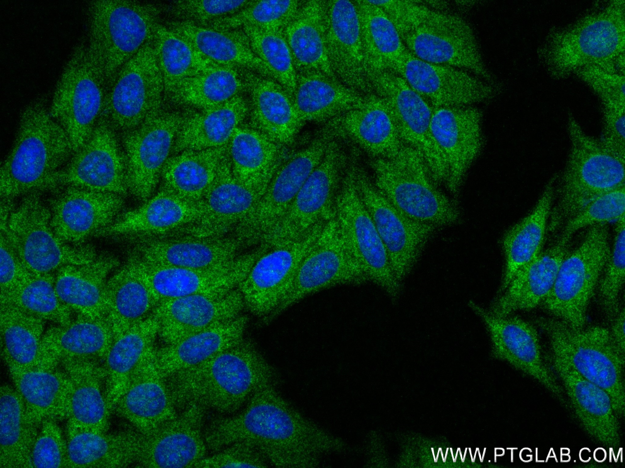 Immunofluorescence (IF) / fluorescent staining of HepG2 cells using MTMR4 Recombinant antibody (84328-1-RR)