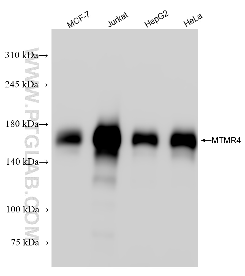 Western Blot (WB) analysis of various lysates using MTMR4 Recombinant antibody (84328-1-RR)