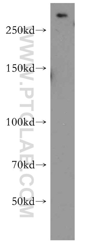 mTOR Polyclonal antibody