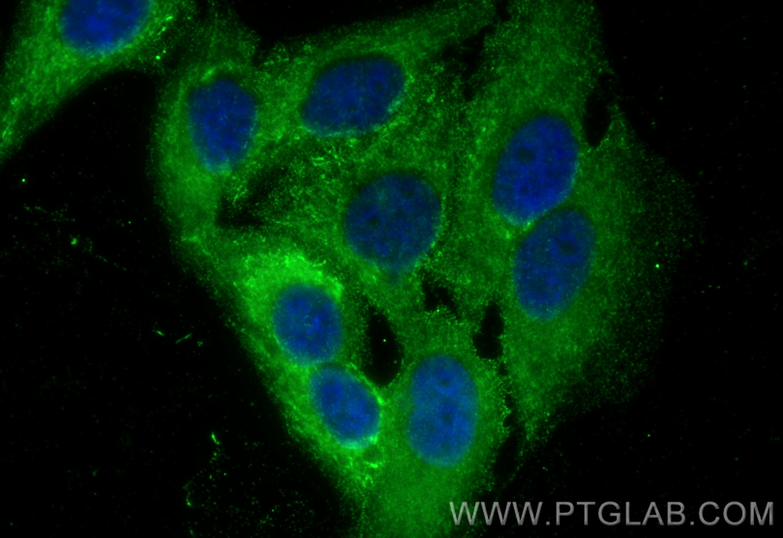 Immunofluorescence (IF) / fluorescent staining of HepG2 cells using mTOR Monoclonal antibody (66888-1-Ig)