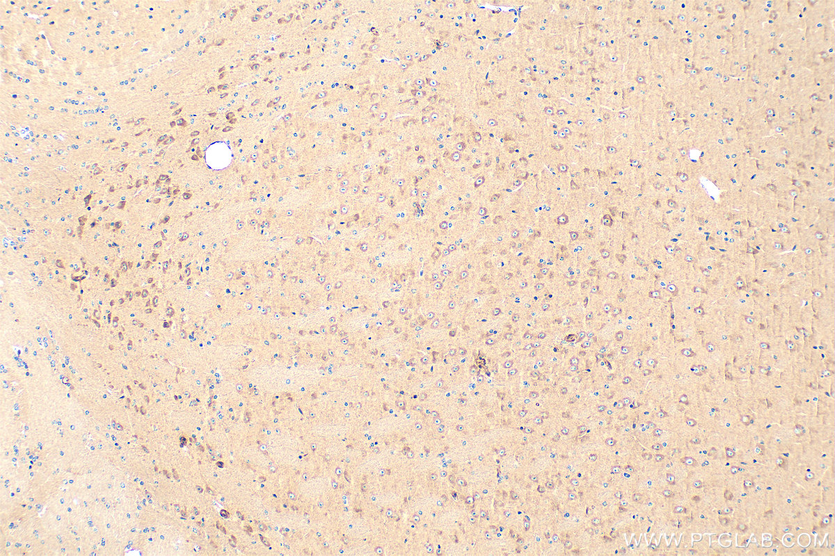 Immunohistochemistry (IHC) staining of mouse brain tissue using mTOR Recombinant monoclonal antibody (81670-1-RR)