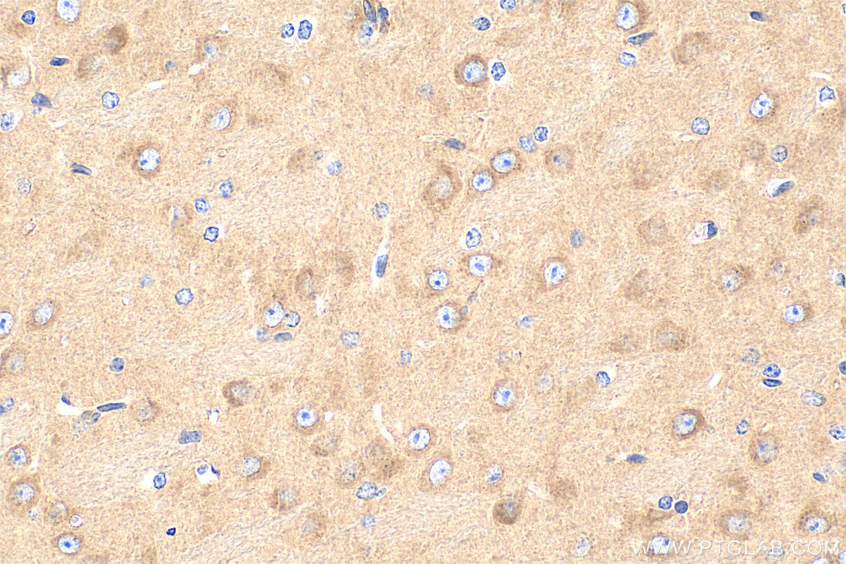 Immunohistochemistry (IHC) staining of mouse brain tissue using mTOR Recombinant monoclonal antibody (81670-1-RR)