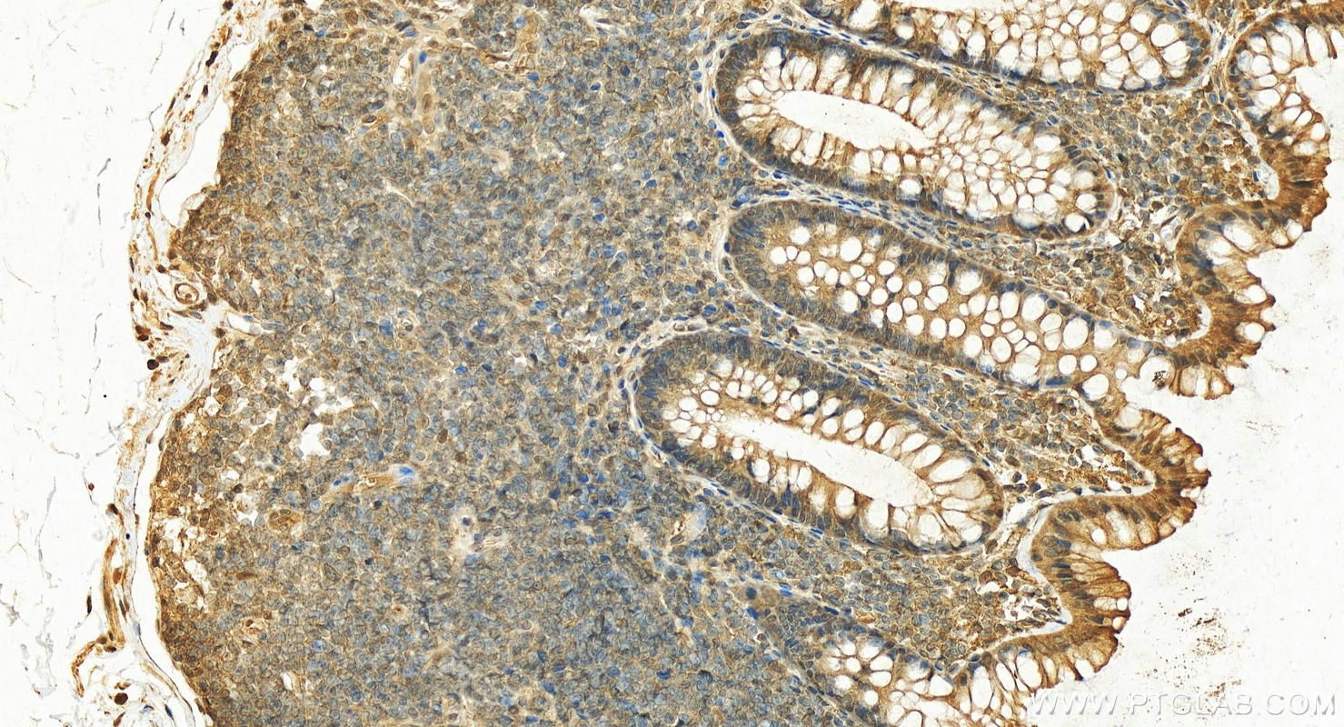 Immunohistochemistry (IHC) staining of human normal colon using MTPN Polyclonal antibody (13508-1-AP)