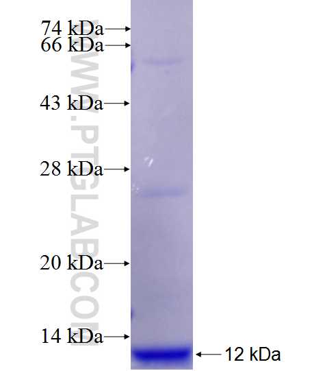 MTSS1L fusion protein Ag27341 SDS-PAGE