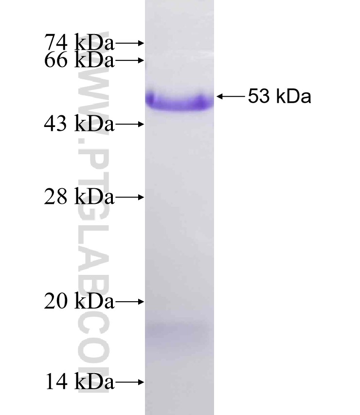 MUC20 fusion protein Ag31840 SDS-PAGE