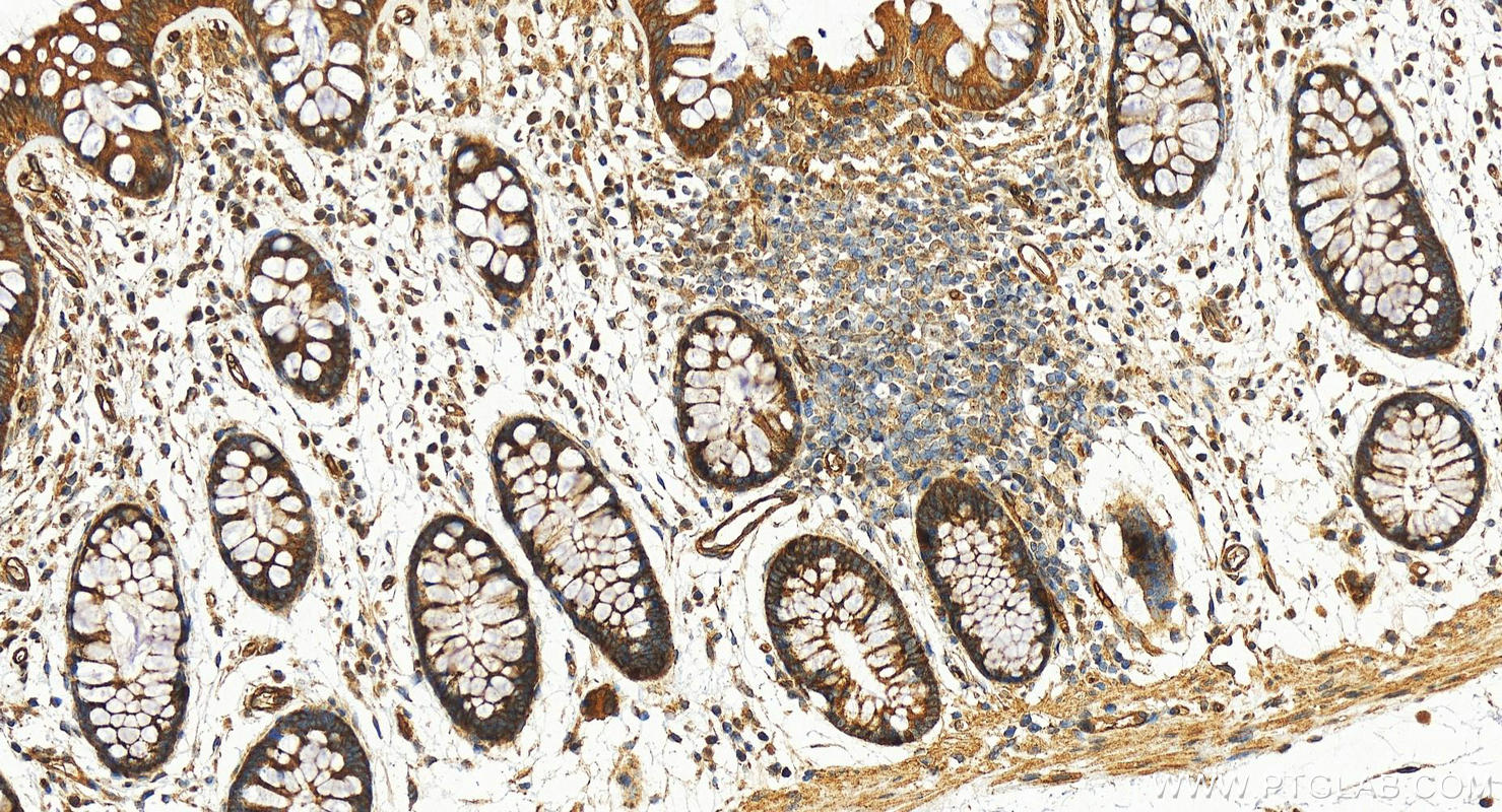 Immunohistochemistry (IHC) staining of human colon tissue using MUC4 Polyclonal antibody (28703-1-AP)