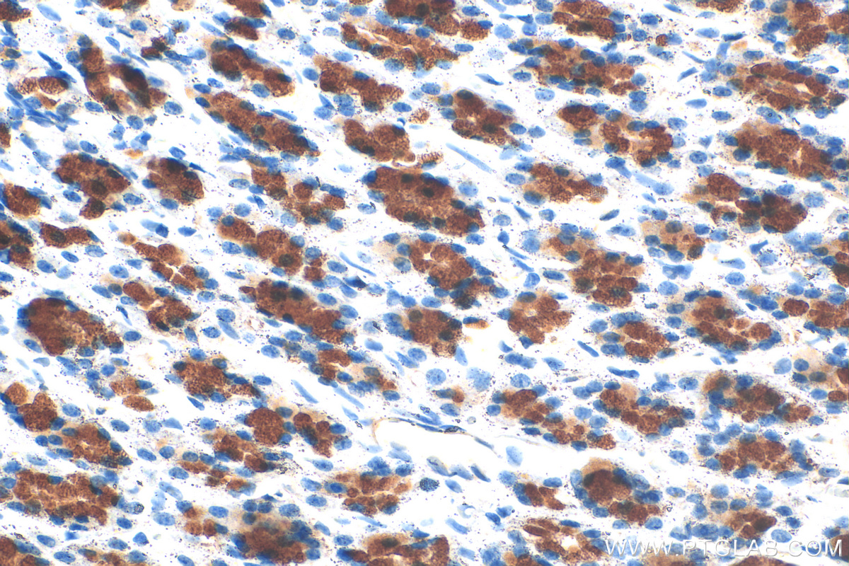 Immunohistochemistry (IHC) staining of rat stomach tissue using MUC5AC Polyclonal antibody (20725-1-AP)