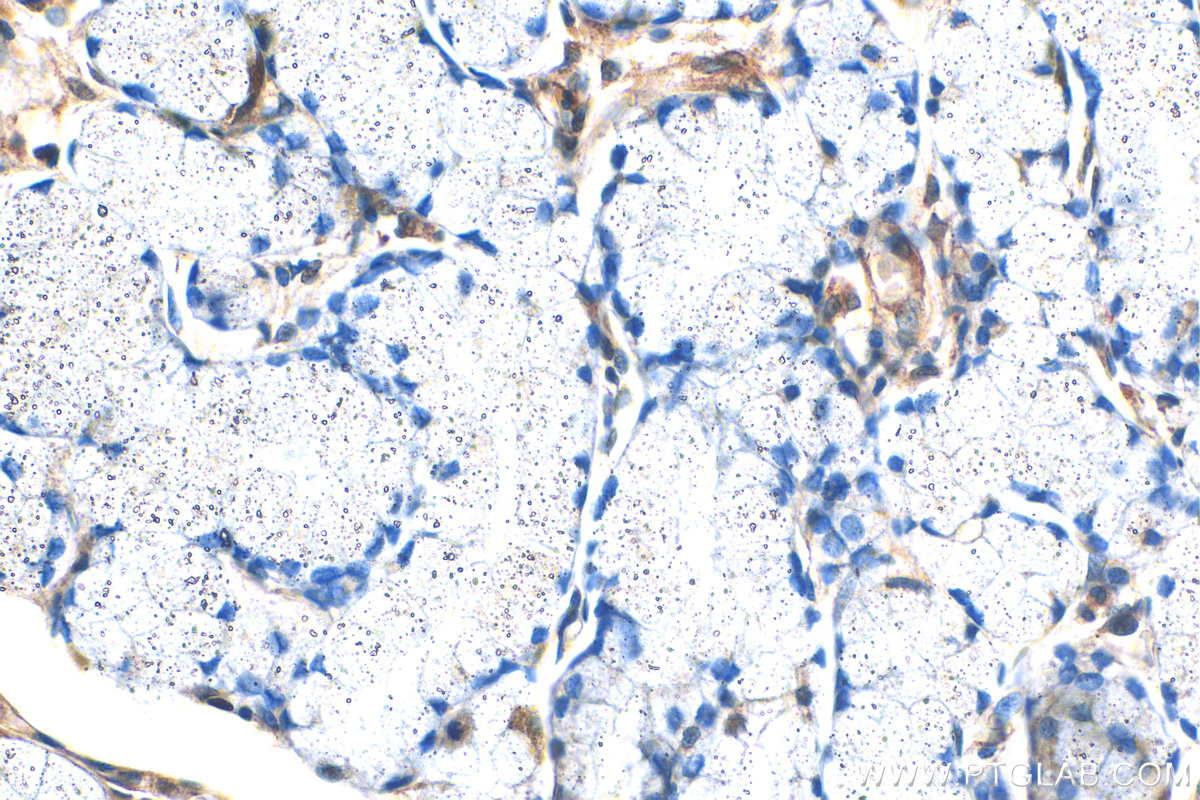 Immunohistochemistry (IHC) staining of human stomach tissue using MUC5AC Polyclonal antibody (20725-1-AP)