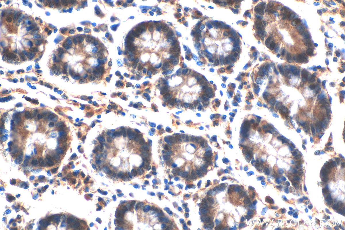 Immunohistochemistry (IHC) staining of human stomach tissue using MUC5AC Polyclonal antibody (20725-1-AP)