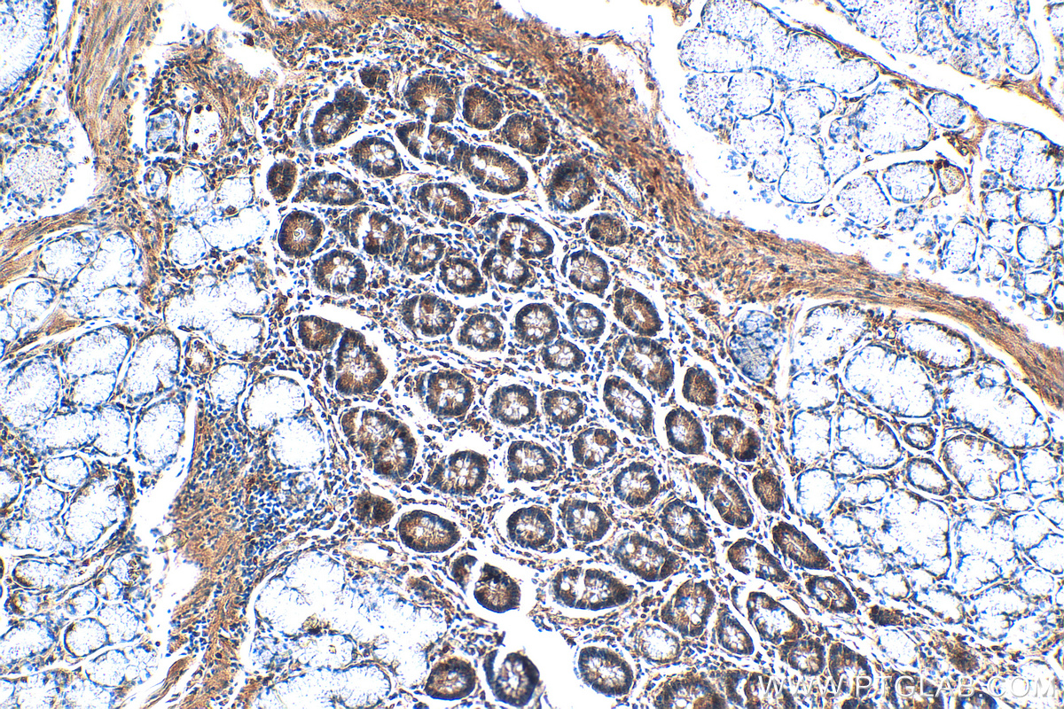 Immunohistochemistry (IHC) staining of human stomach tissue using MUC5AC Polyclonal antibody (20725-1-AP)