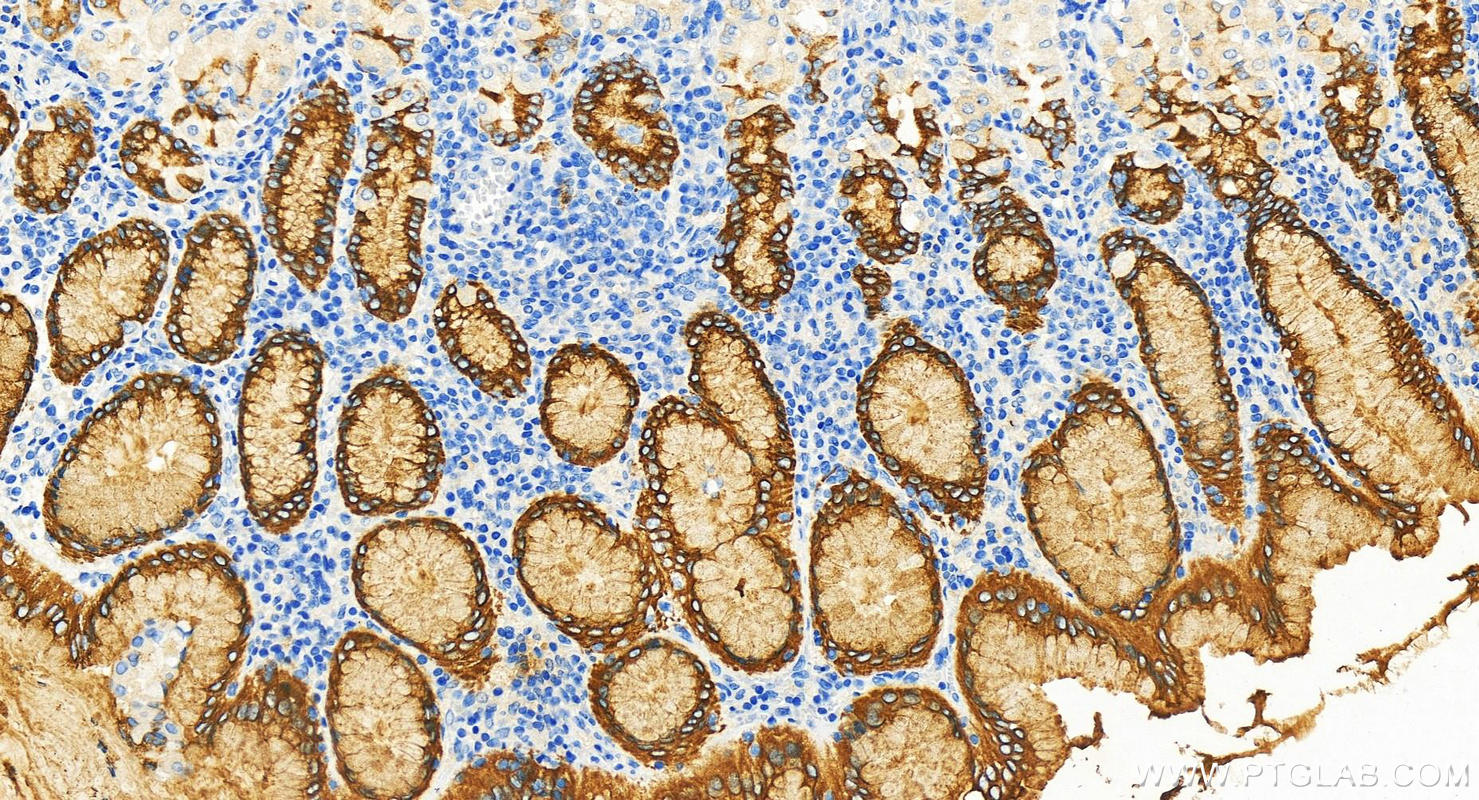 Immunohistochemistry (IHC) staining of human stomach tissue using MUC5AC Polyclonal antibody (30408-1-AP)