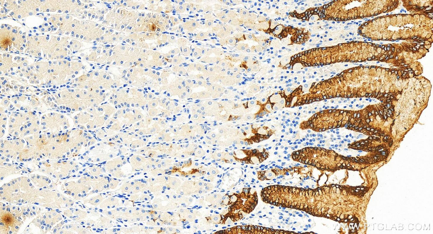 Immunohistochemistry (IHC) staining of human stomach tissue using MUC5AC Polyclonal antibody (30408-1-AP)