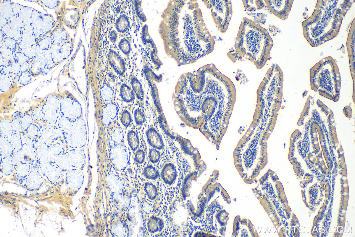 Immunohistochemistry (IHC) staining of human stomach tissue using MUC5AC Polyclonal antibody (30408-1-AP)