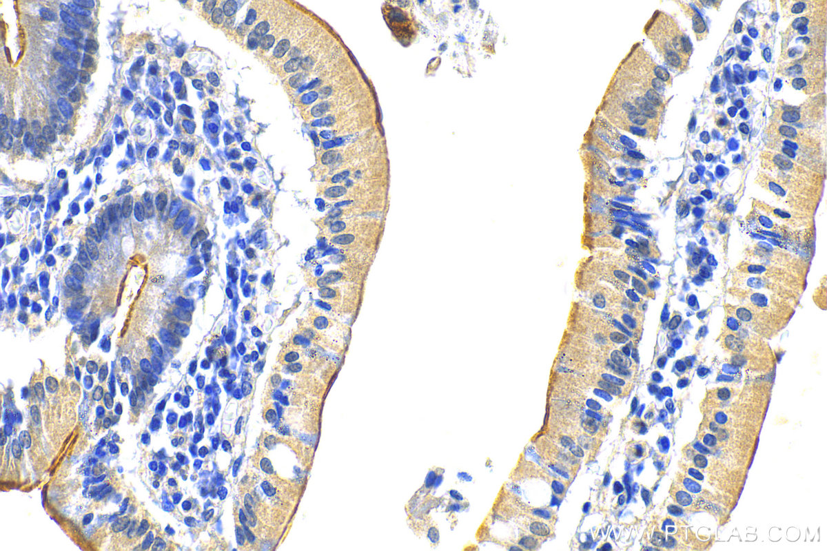 Immunohistochemistry (IHC) staining of human stomach tissue using MUC5AC Polyclonal antibody (30408-1-AP)