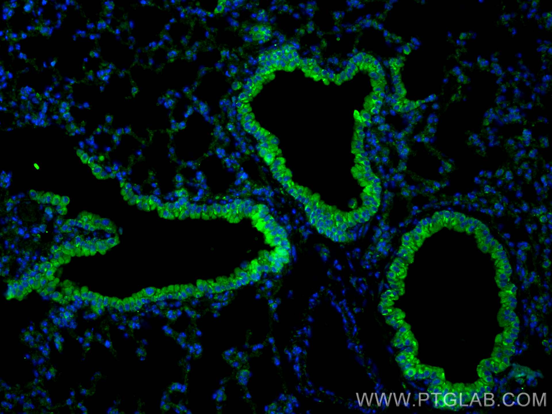 Immunofluorescence (IF) / fluorescent staining of mouse lung tissue using MUC5B Polyclonal antibody (28118-1-AP)