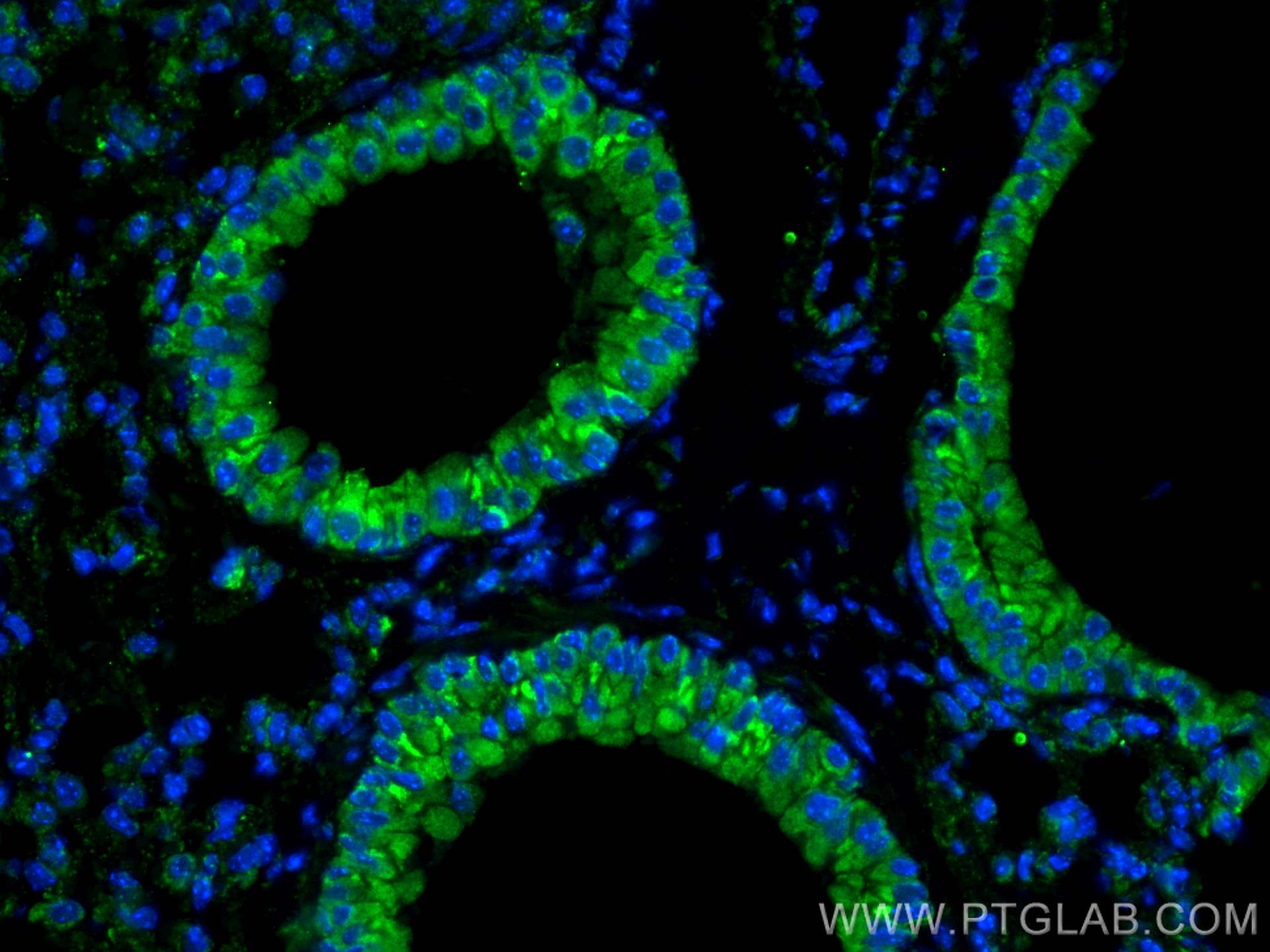 Immunofluorescence (IF) / fluorescent staining of mouse lung tissue using MUC5B Polyclonal antibody (28118-1-AP)