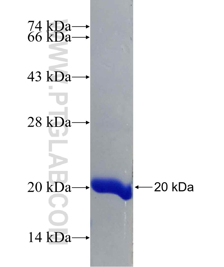 MUM1 fusion protein Ag29894 SDS-PAGE