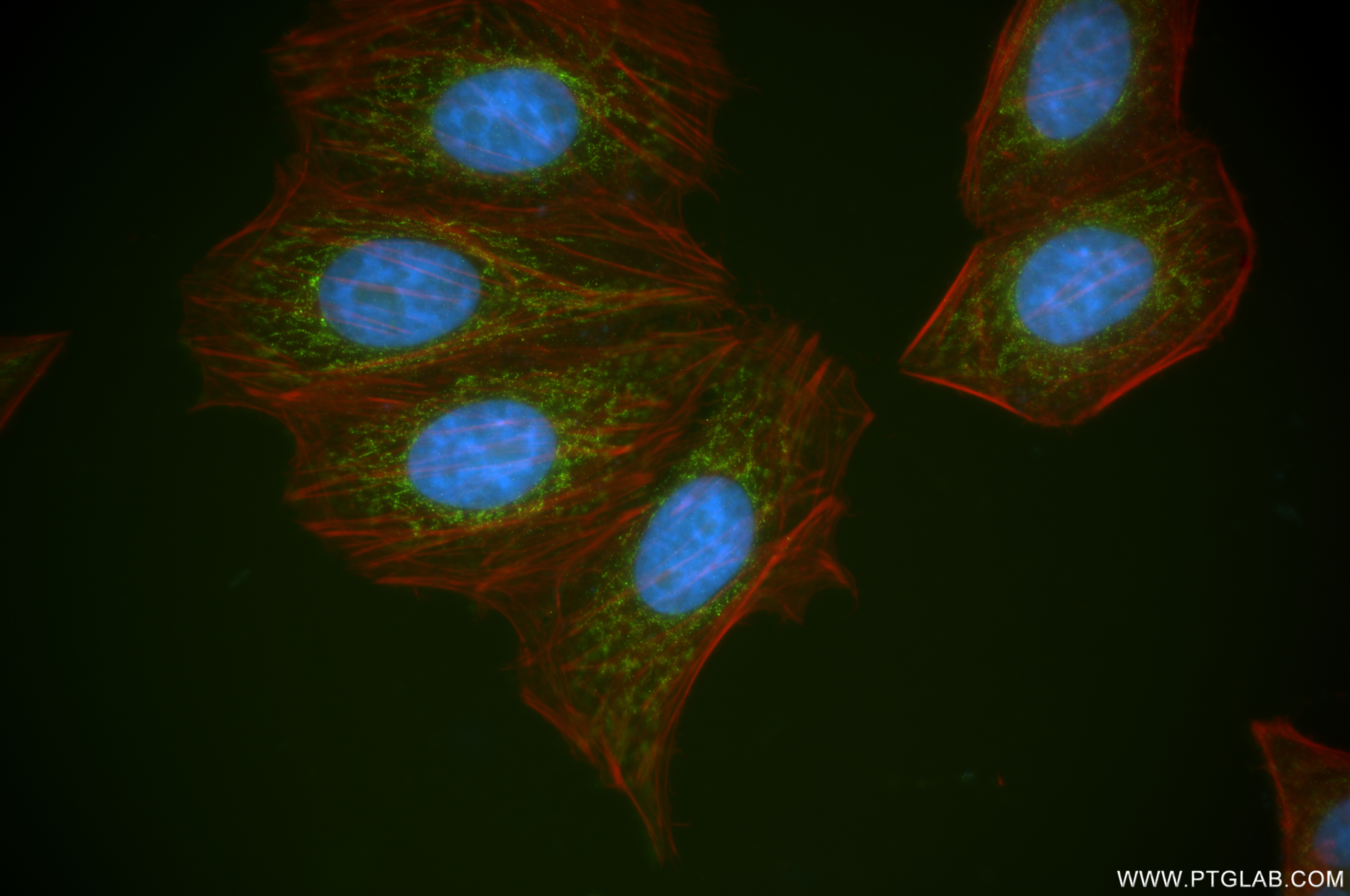 Immunofluorescence (IF) / fluorescent staining of HepG2 cells using Methylmalonyl Coenzyme A mutase/MUT Recombinant an (84879-6-RR)