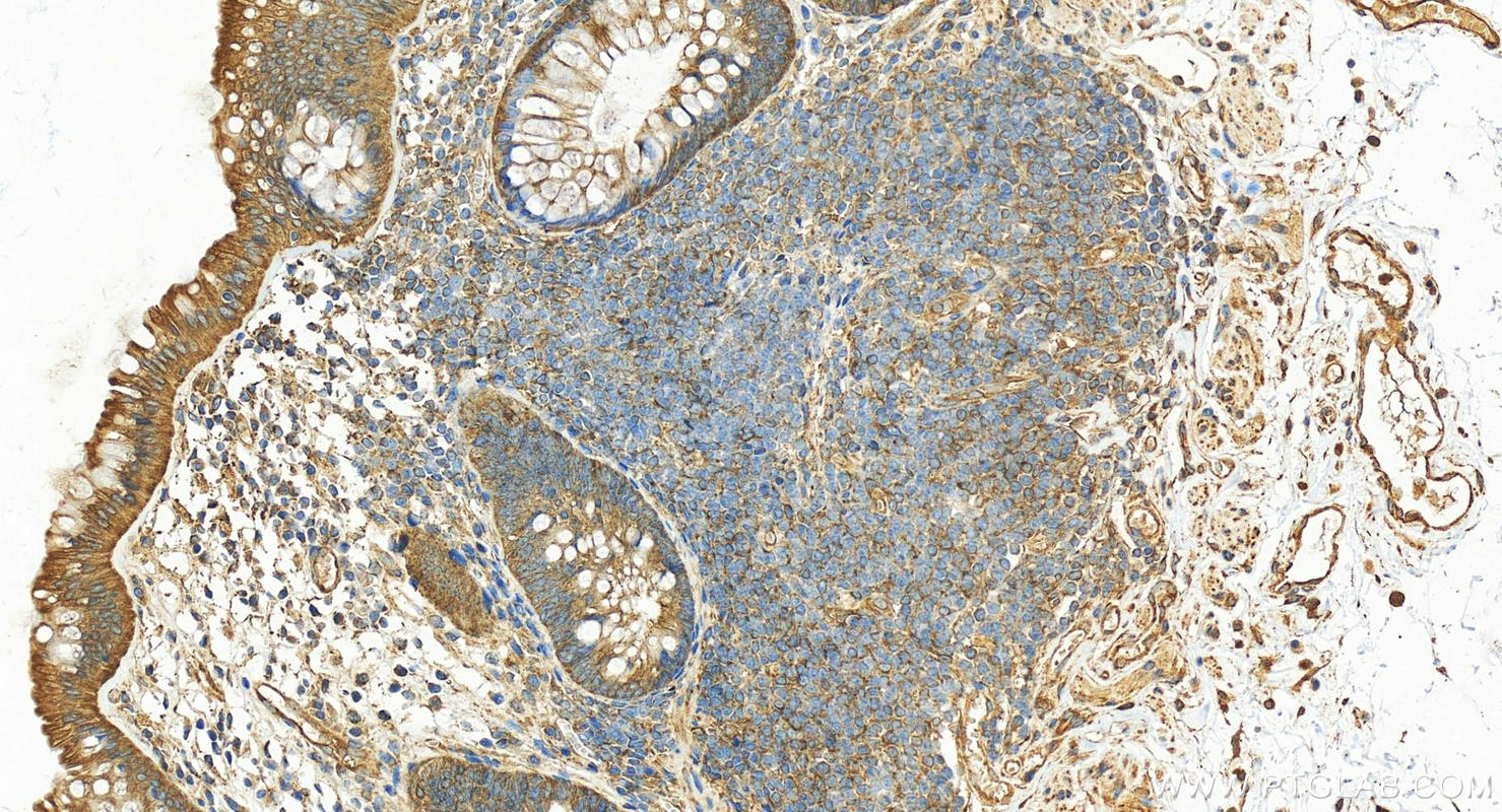 Immunohistochemistry (IHC) staining of human normal colon using MVP/LRP Polyclonal antibody (16478-1-AP)