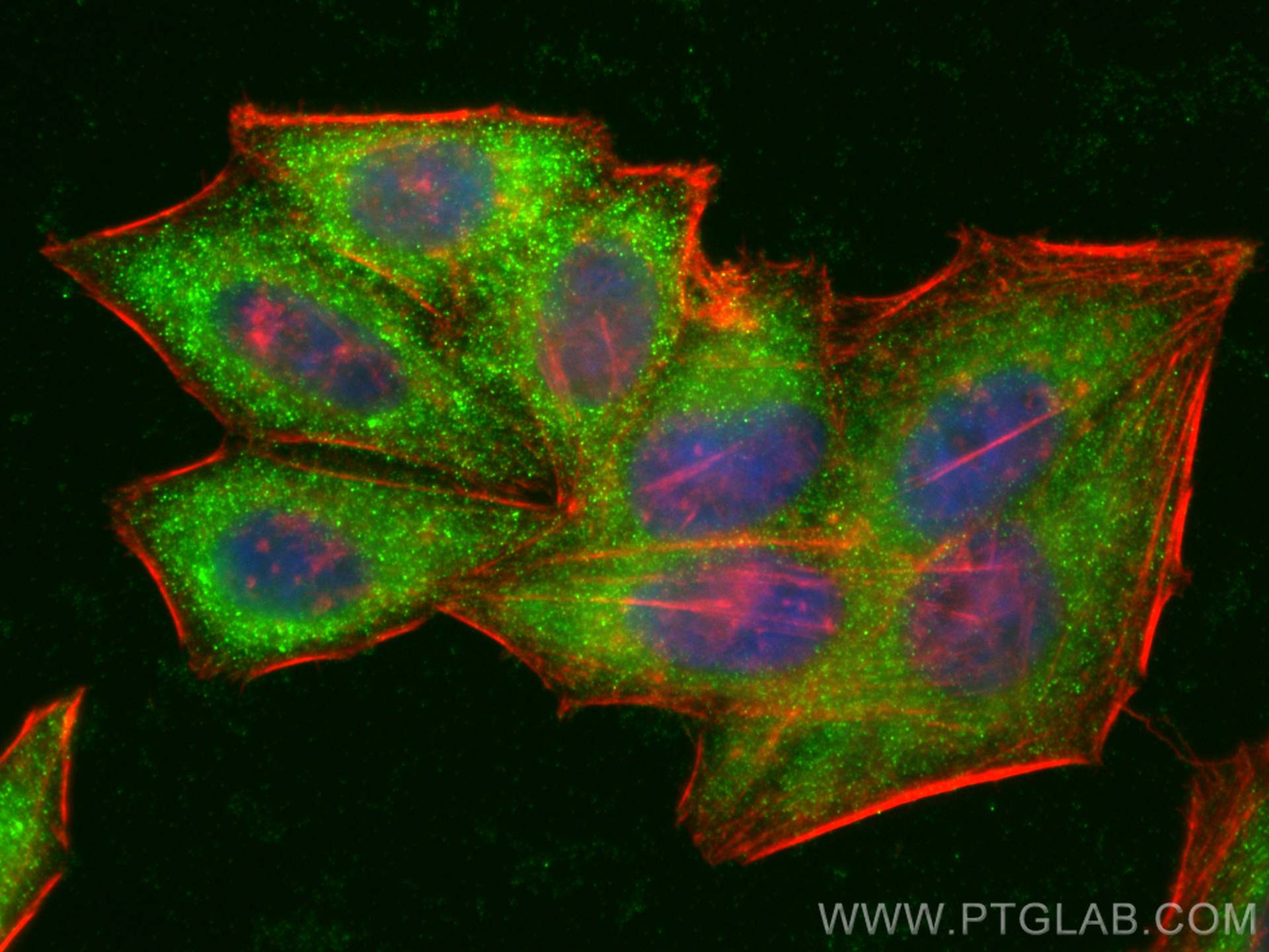 Immunofluorescence (IF) / fluorescent staining of HepG2 cells using MVP/LRP Polyclonal antibody (16478-1-AP)