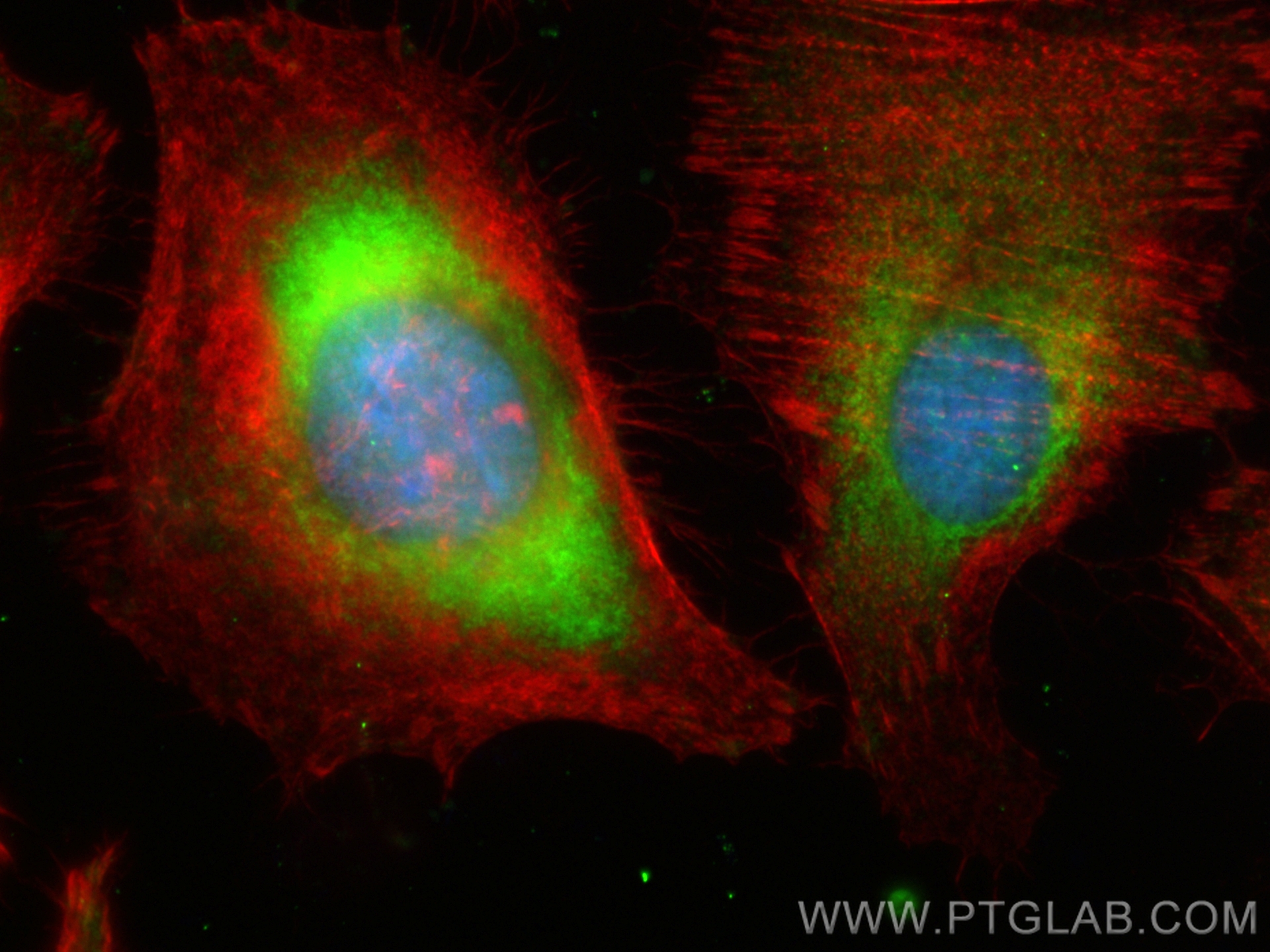 Immunofluorescence (IF) / fluorescent staining of HepG2 cells using CoraLite® Plus 488-conjugated MVP/LRP Polyclonal a (CL488-16478)