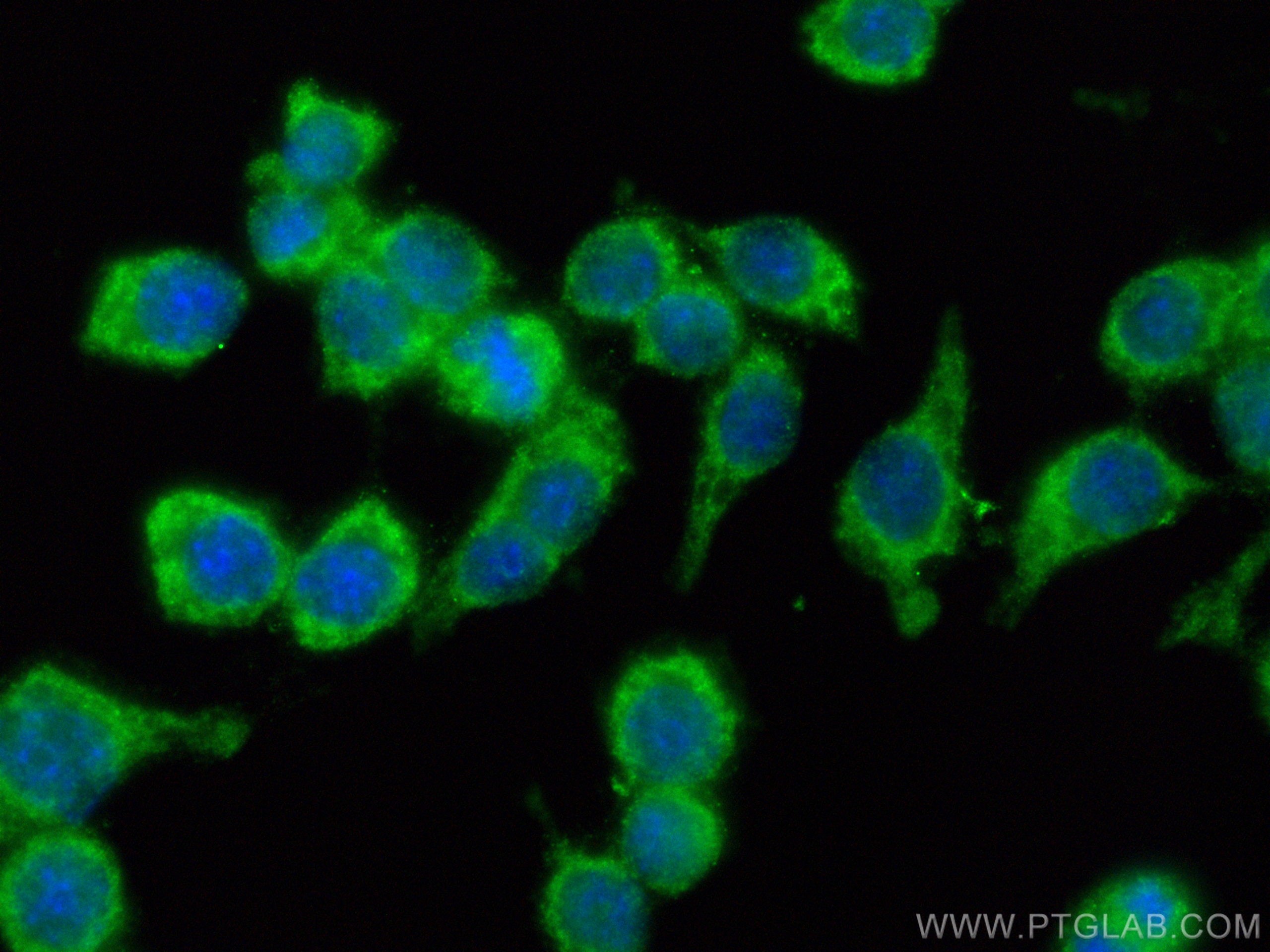 Immunofluorescence (IF) / fluorescent staining of A549 cells using MX1 Recombinant antibody (82677-1-RR)