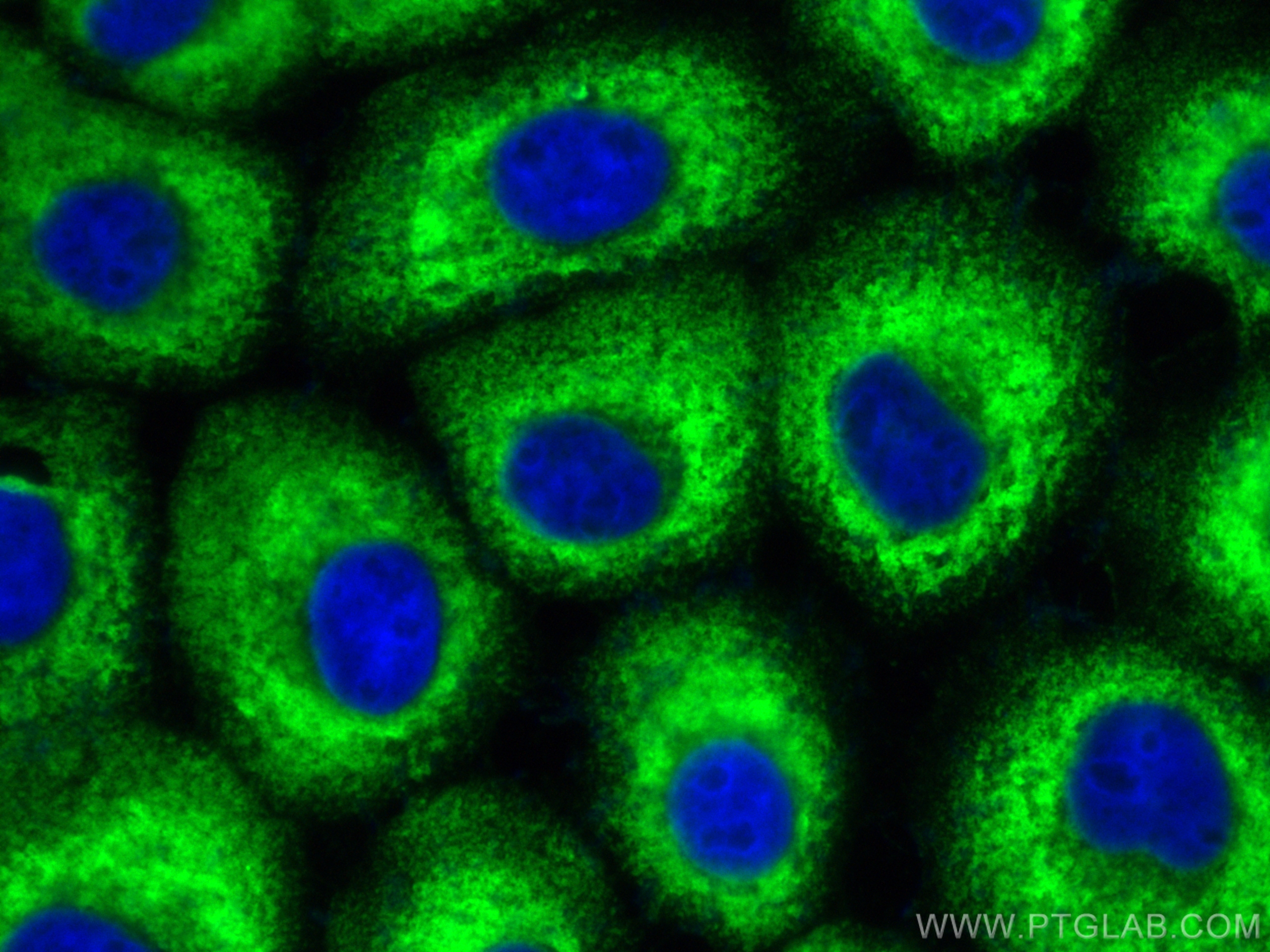Immunofluorescence (IF) / fluorescent staining of A431 cells using CoraLite® Plus 488-conjugated MX1 Recombinant anti (CL488-82677)