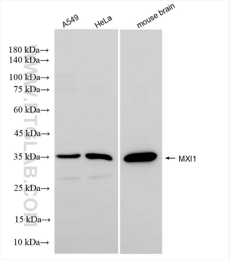 Western Blot (WB) analysis of various lysates using MXI1 Recombinant antibody (84733-5-RR)