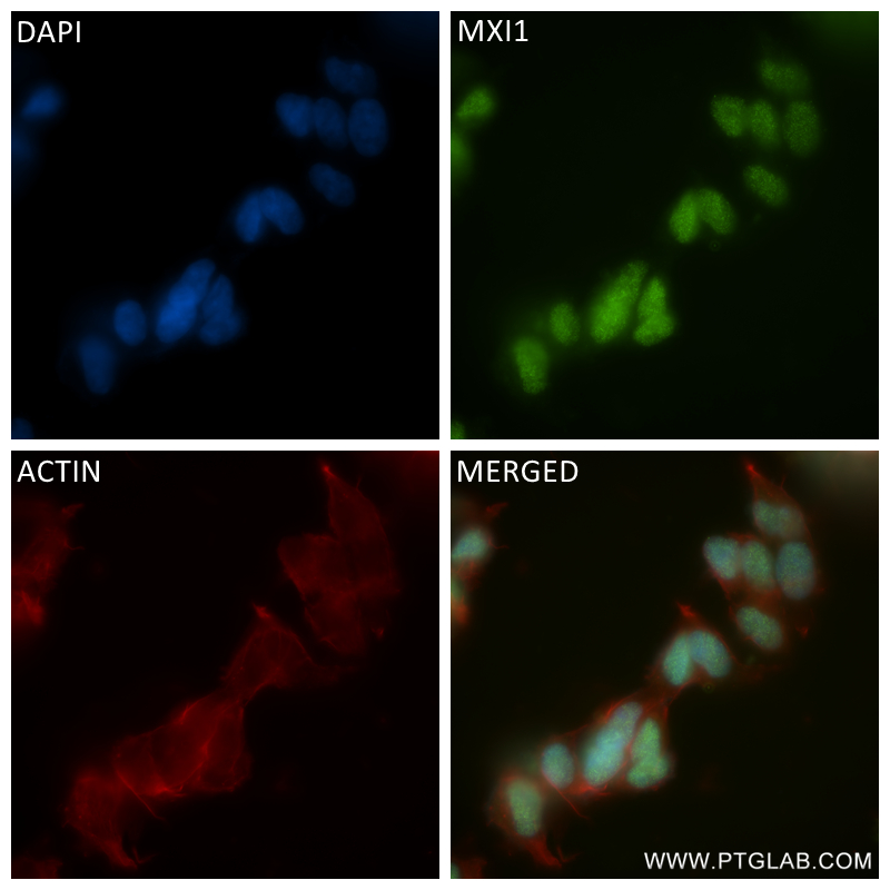 Immunofluorescence (IF) / fluorescent staining of SH-SY5Y cells using MXI1 Recombinant antibody (84733-6-RR)